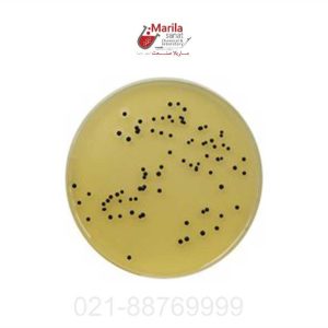محیط کشت سالمونلا شیگلا (SS AGAR) کیولب